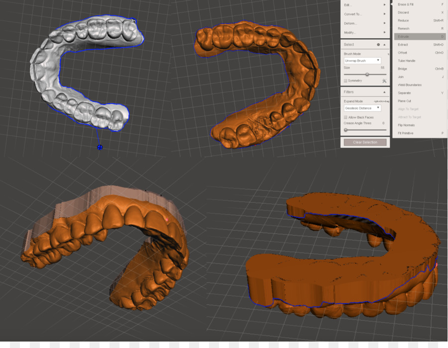 Cerec，3d Percetakan PNG