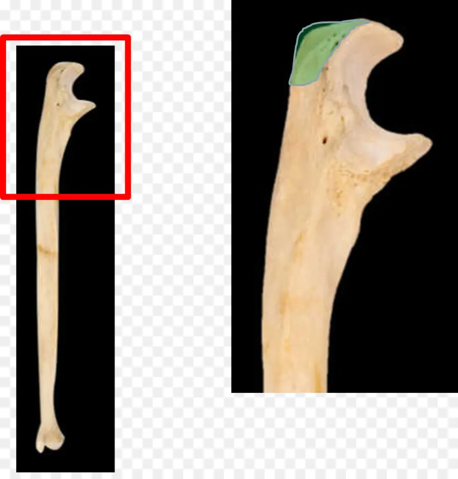 Olecranon，Proses Koronoid Ulna PNG