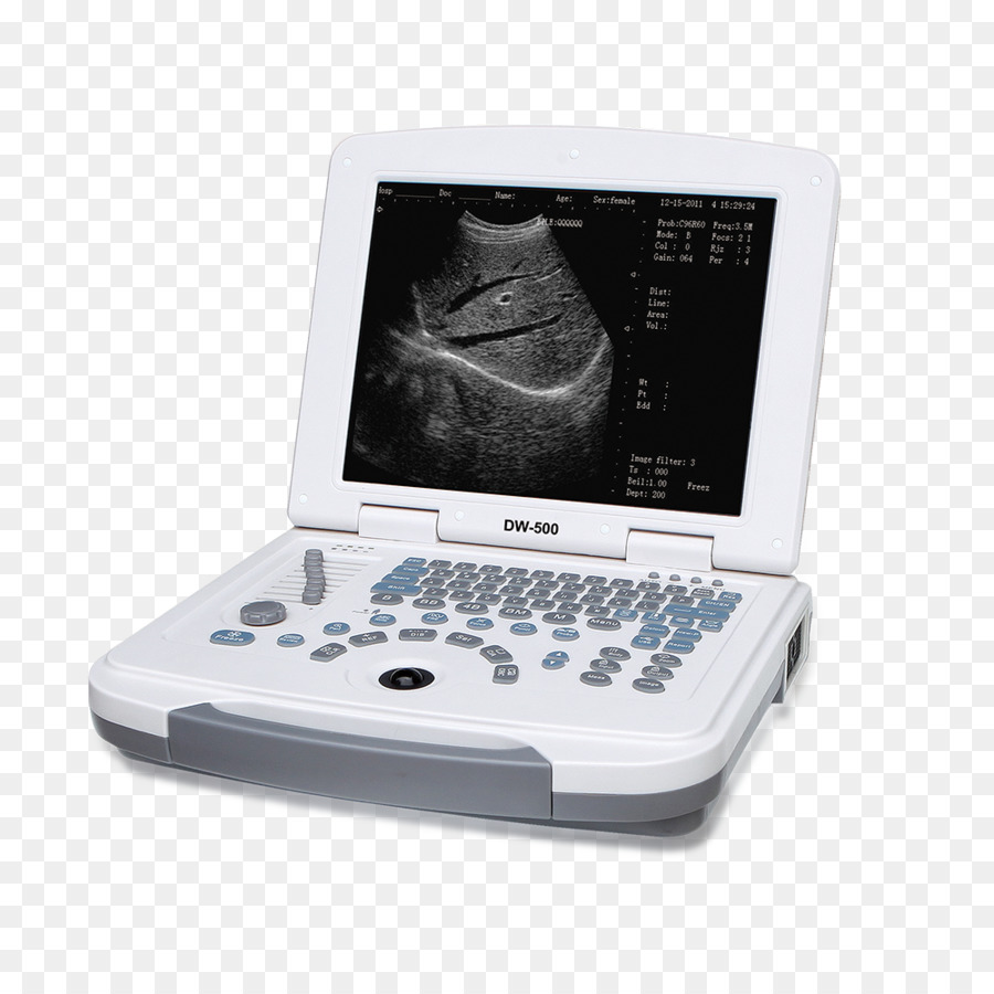 Ultrasonografi，Usg PNG