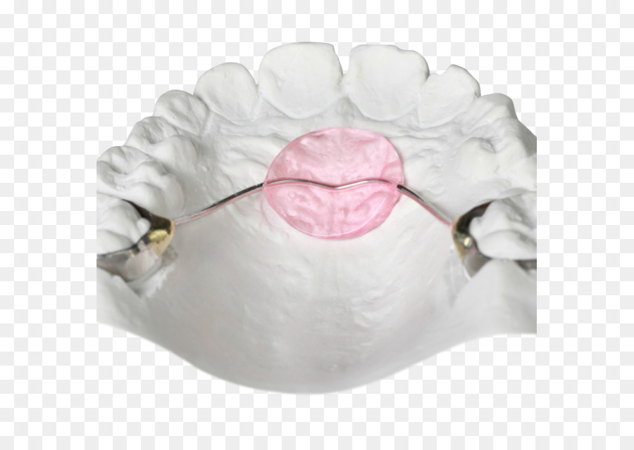 Orthodonsi，Bionator PNG