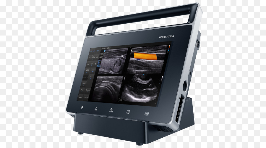 Ultrasonografi，Samsung PNG