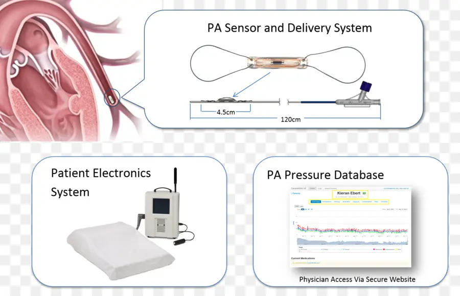 Sensor Pa，Jantung PNG