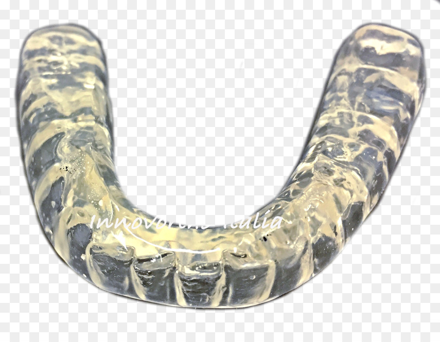 Oklusal Splint, Bruxism, Sendi Temporomandibular Gambar Png