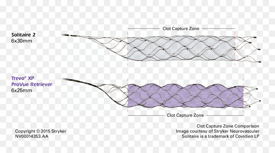 Stryker Corporation，Stenting PNG