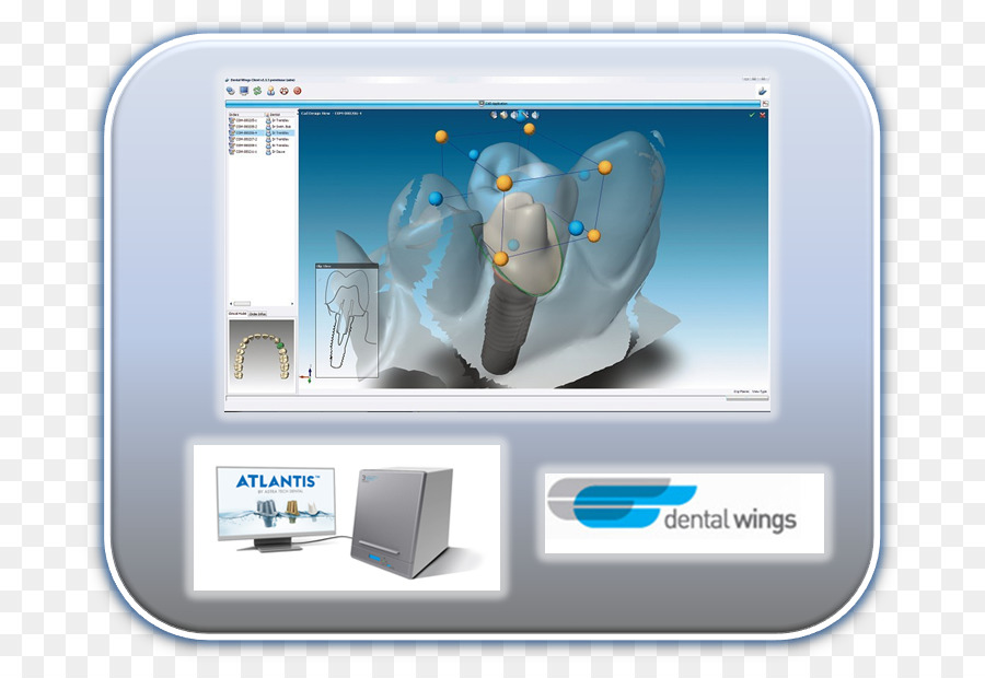 Cadcam Kedokteran Gigi，Kedokteran Gigi PNG