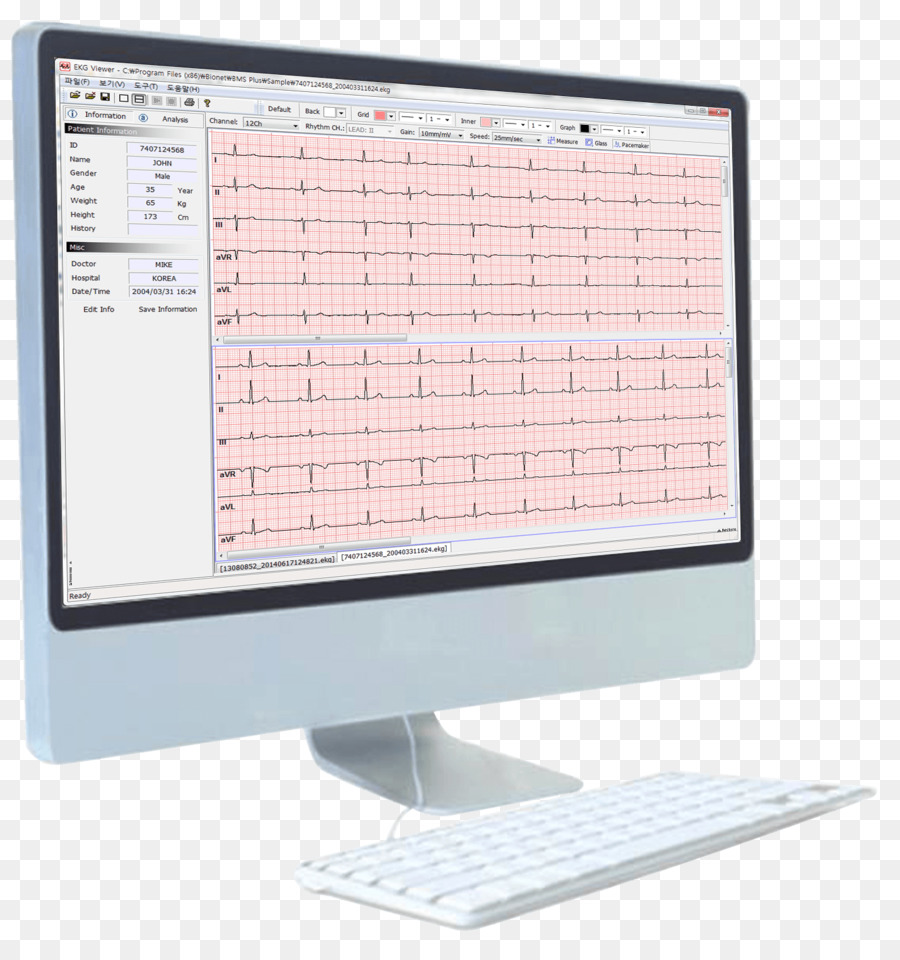 Artun Medis Teknis Pelayanan，Elektrokardiografi PNG