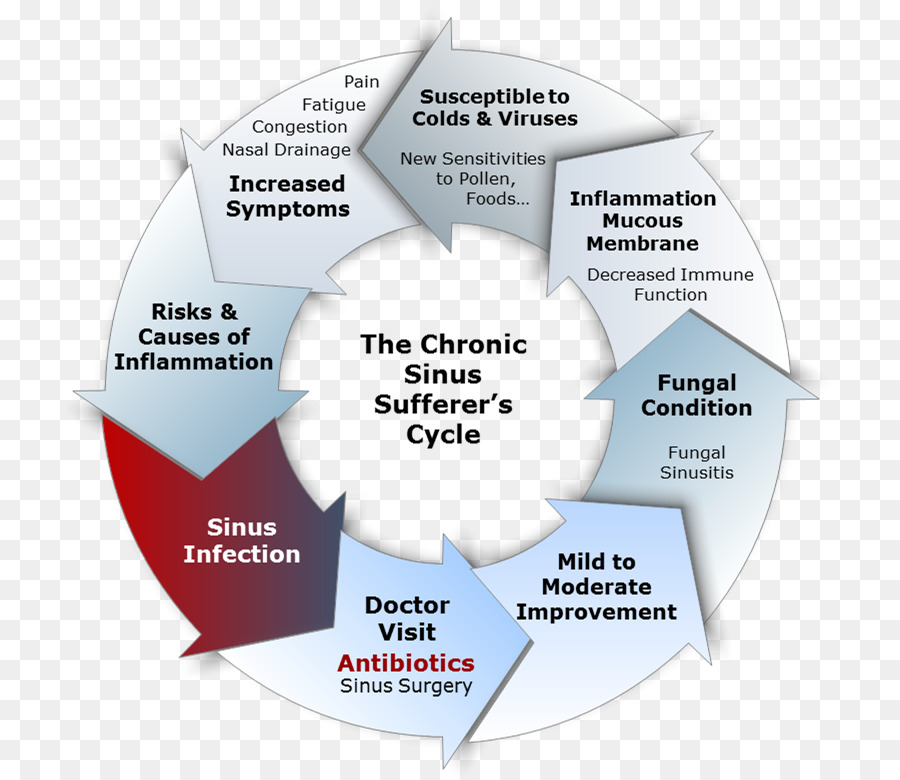 Infeksi Sinus，Sinus PNG