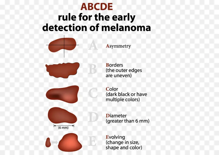 Deteksi Melanoma，Kulit PNG