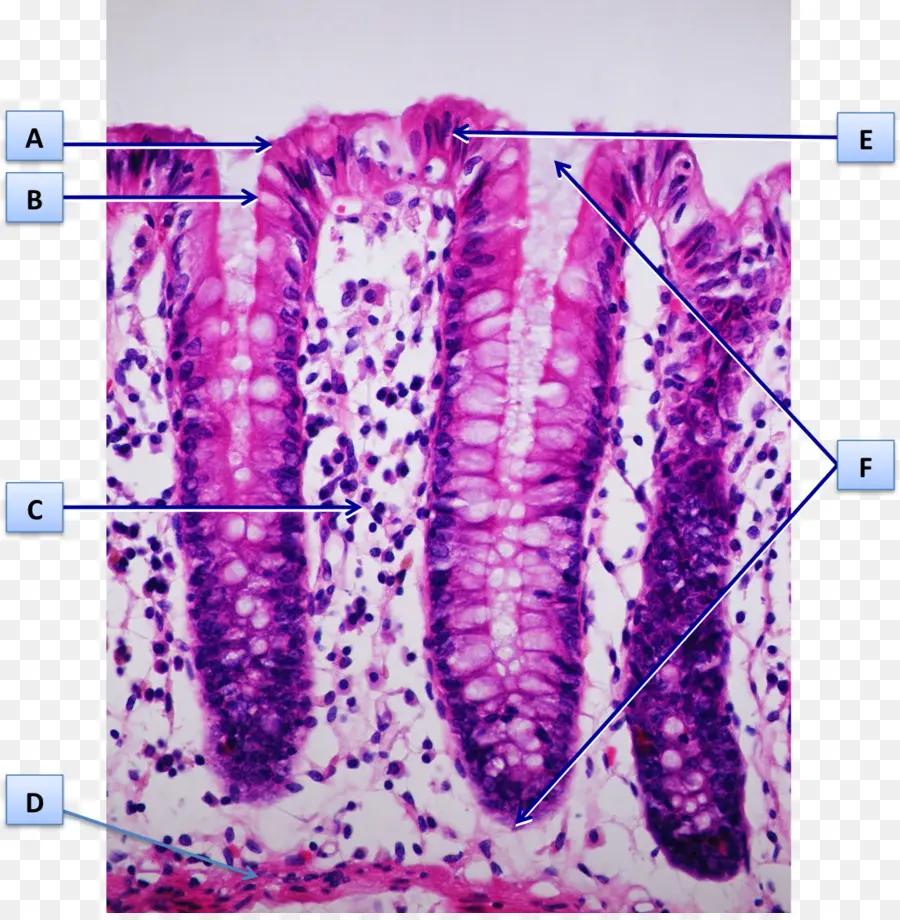 Selaput Lendir，Kelenjar Usus PNG