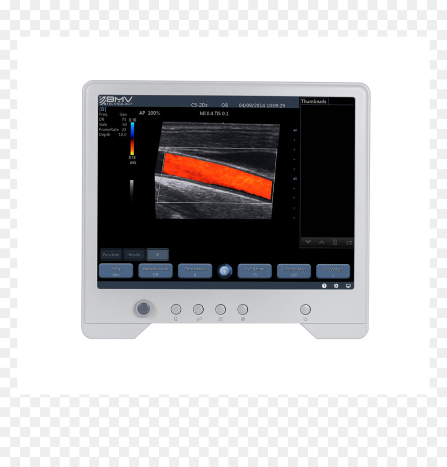 Tampilan Perangkat，Ultrasonografi PNG