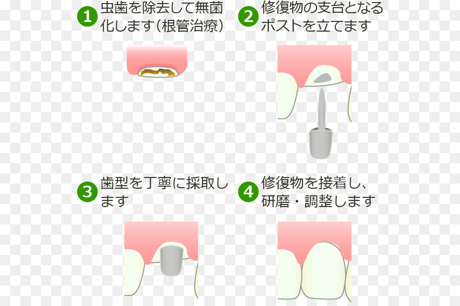 Barat Chiba Fu Ra ワ ー Gigi Copy Sakit Waseda Bruto Daerah・barat Chiba，Dokter Gigi PNG