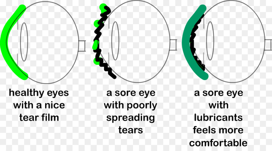 Diagram Mata，Air Mata PNG