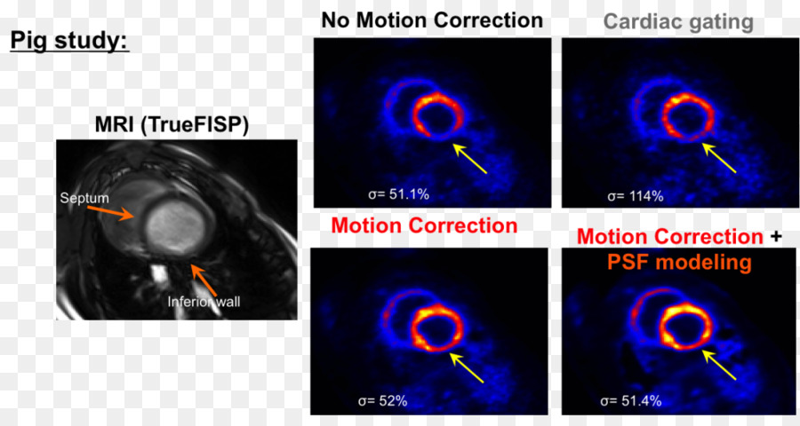 Pencitraan Medis，Positron Emission Tomography PNG