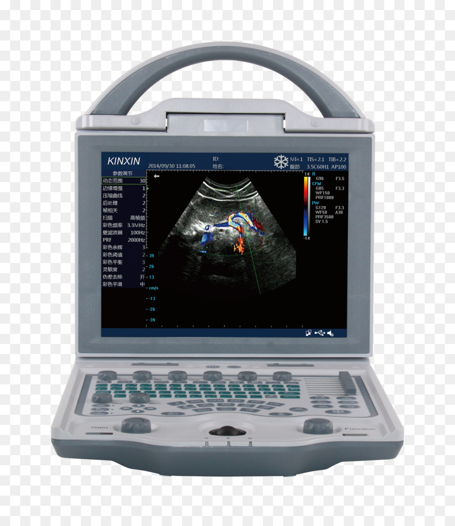 Ultrasonografi，Oftalmologi PNG