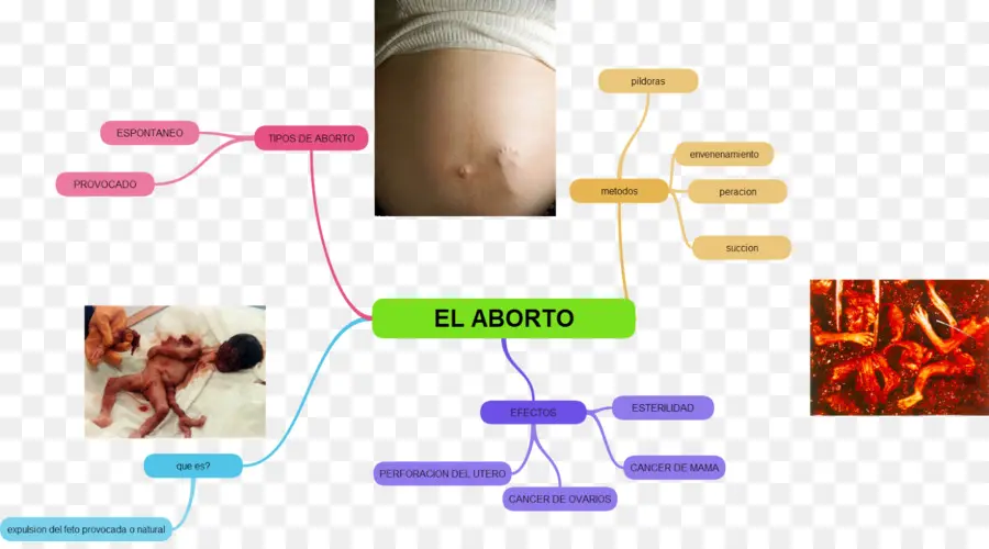 Diagram Aborsi，Medis PNG