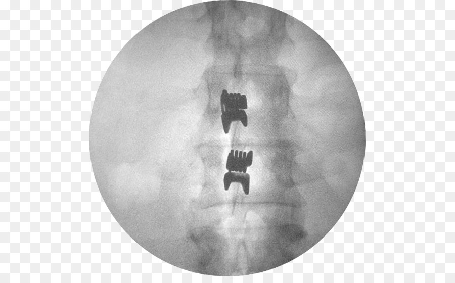 Interspinales Otot，Vertebral Kolom PNG