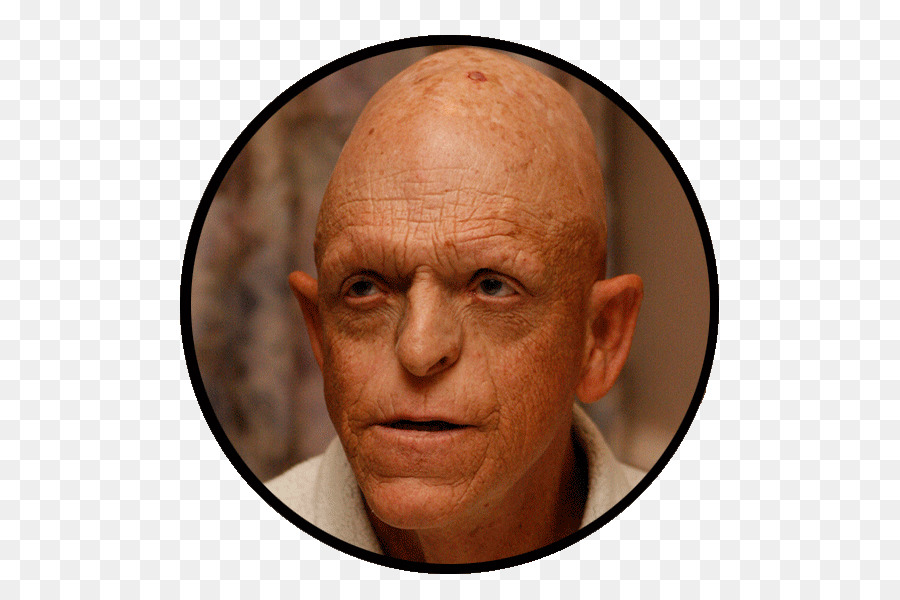 Michael Berryman，Perbukitan Memiliki Mata PNG