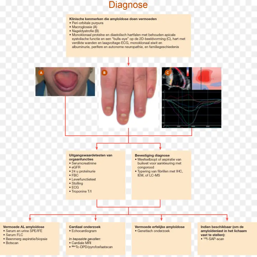 Bagan Diagnosis，Medis PNG