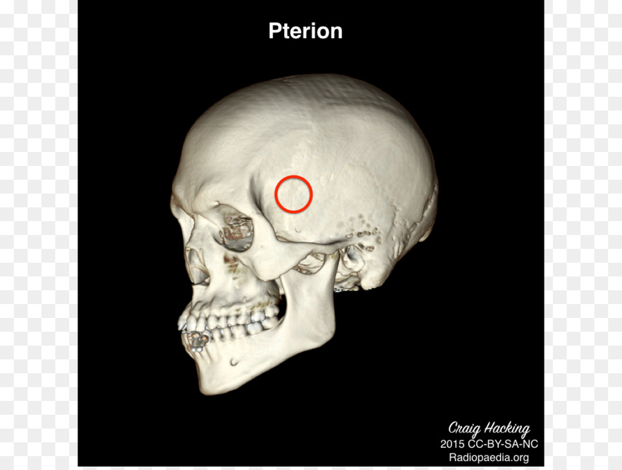 Anatomi，Terapi Fisik PNG