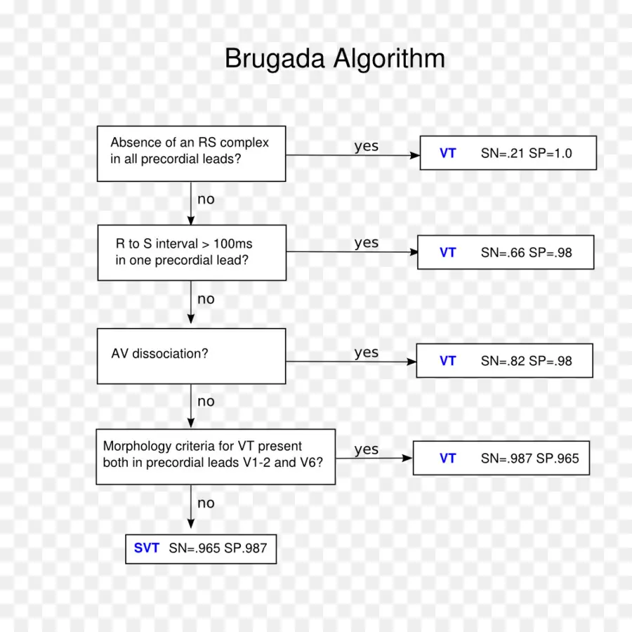Sindrom Brugada，Elektrokardiografi PNG