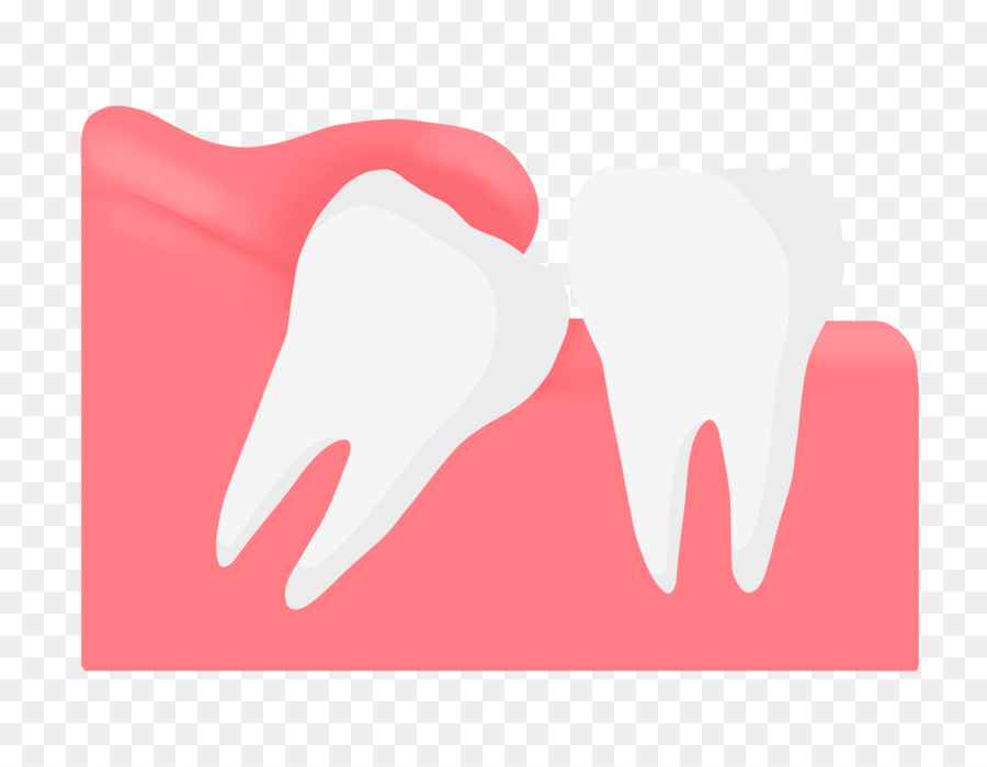 Удаление зуба семерки. Зуб. Мудрый зуб стоматология. Зуб картинка.